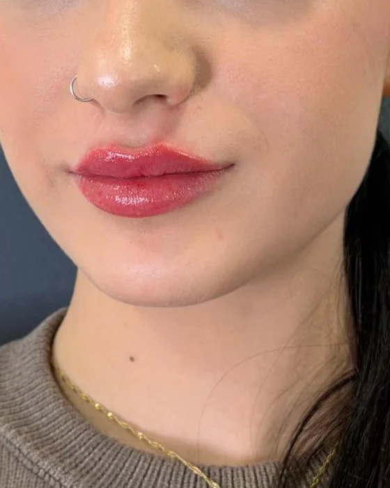 Nariz, labios y mentón de perfil facial armónico
